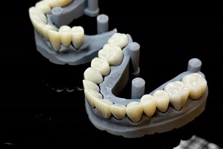Mẫu hàm răng in 3D dùng để lên kế hoạch phục hình