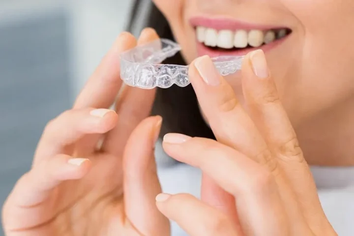 Khách cầm khay niềng trong suốt trước nụ cười