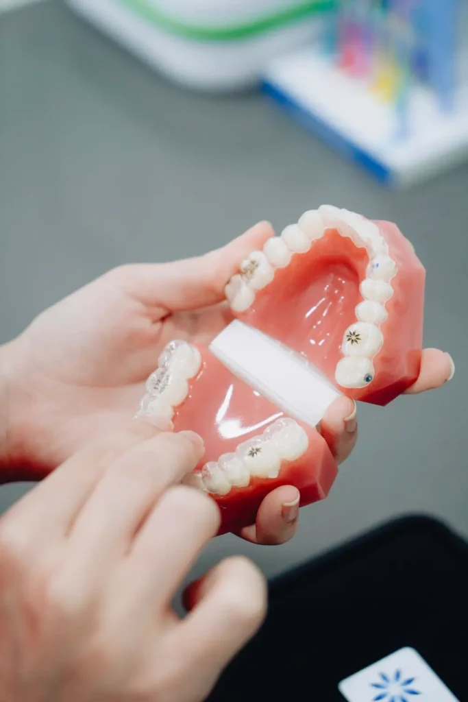 Khay niềng răng trong suốt cầm trên tay